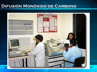Difusión Monóxido de Carbono
 