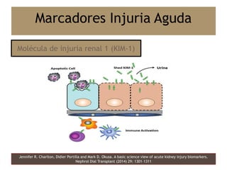 Jennifer R. Charlton, Didier Portilla and Mark D. Okusa. A basic science view of acute kidney injury biomarkers.
Nephrol Dial Transplant (2014) 29: 1301–1311
Marcadores Injuria Aguda
Molécula de injuria renal 1 (KIM-1)
 