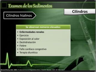 Examen de los Sedimentos
Cilindros
Cilindros hialinos
Se observan números elevados:
• Enfermedades renales
• Ejercicio
• Exposición al calor
• Deshidratación
• Fiebre
• Fallo cardíaco congestivo
• Terapia diurética
Bernard Herny, John. 2005. El Laboratorio en el Diagnóstico Clínico. Madrid : Marbán, 2005. 84-7101-463-7.
 