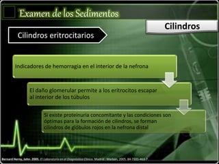 Examen de los Sedimentos
Cilindros
Cilindros eritrocitarios
Bernard Herny, John. 2005. El Laboratorio en el Diagnóstico Clínico. Madrid : Marbán, 2005. 84-7101-463-7.
Indicadores de hemorragia en el interior de la nefrona
El daño glomerular permite a los eritrocitos escapar
al interior de los túbulos
Si existe proteinuria concomitante y las condiciones son
óptimas para la formación de cilindros, se forman
cilindros de glóbulos rojos en la nefrona distal
 