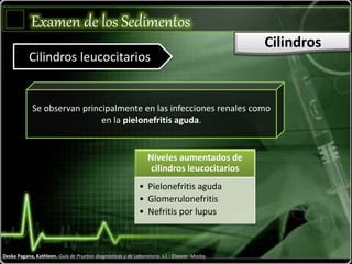 Examen de los Sedimentos
Cilindros
Cilindros leucocitarios
Deska Pagana, Kathleen. Guía de Pruebas diagnósticas y de Laboratorio. s.l. : Elsevier-Mosby.
Se observan principalmente en las infecciones renales como
en la pielonefritis aguda.
Niveles aumentados de
cilindros leucocitarios
• Pielonefritis aguda
• Glomerulonefritis
• Nefritis por lupus
 