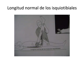 Longitud normal de los isquiotibiales
 
