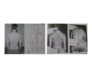 Pruebas de longitud muscular