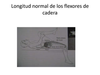 Longitud normal de los flexores de
             cadera
 