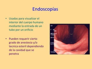 Endoscopías
• Usadas para visualizar el
interior del cuerpo humano
mediante la entrada de un
tubo por un orificio
• Pueden requerir cierto
grado de anestesia y/o
tecnica esteril dependiendo
de la cavidad que se
penetra
 