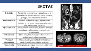 UROTAC
Definición Tomografía computarizada especializada en la
evaluación del aparato urinario (riñones, uréteres
y vejiga), utilizando contraste iodado.
Cómo se realiza Paciente en decúbito supino, se administra
contraste IV y se toman imágenes en diferentes
fases (nefrográfica, excretora).
Qué se observa Litiasis urinaria, obstrucciones, tumores renales o
uroteliales, malformaciones, hidronefrosis,
traumatismos.
Indicaciones Cólico renal, hematuria, sospecha de tumor
urológico, anomalías congénitas.
Ventajas/
Limitaciones
Alta resolución y sensibilidad. Limitaciones:
radiación y nefrotoxicidad del contraste.
Tratamiento No terapéutico, pero guía intervenciones (cirugía,
litotricia).
 