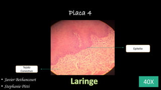 Placa 4
40X
Epitelio
Tejido
Conectivo
• Javier Bethancourt
• Stephanie Pitti