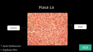 Placa 13
40X
Linfocitos
Sangre
• Javier Bethancourt
• Stephanie Pitti