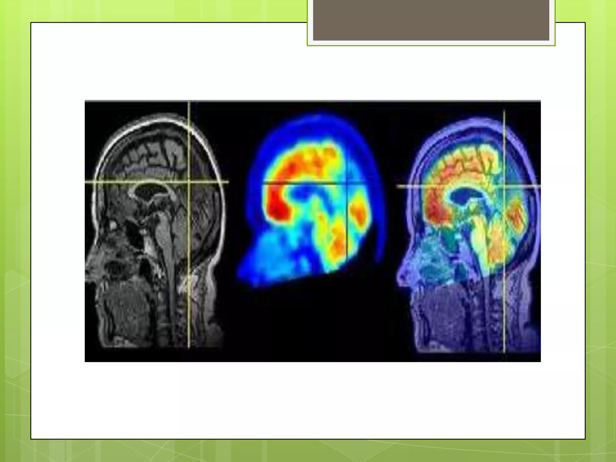 Pruebas Neurofisiologicas