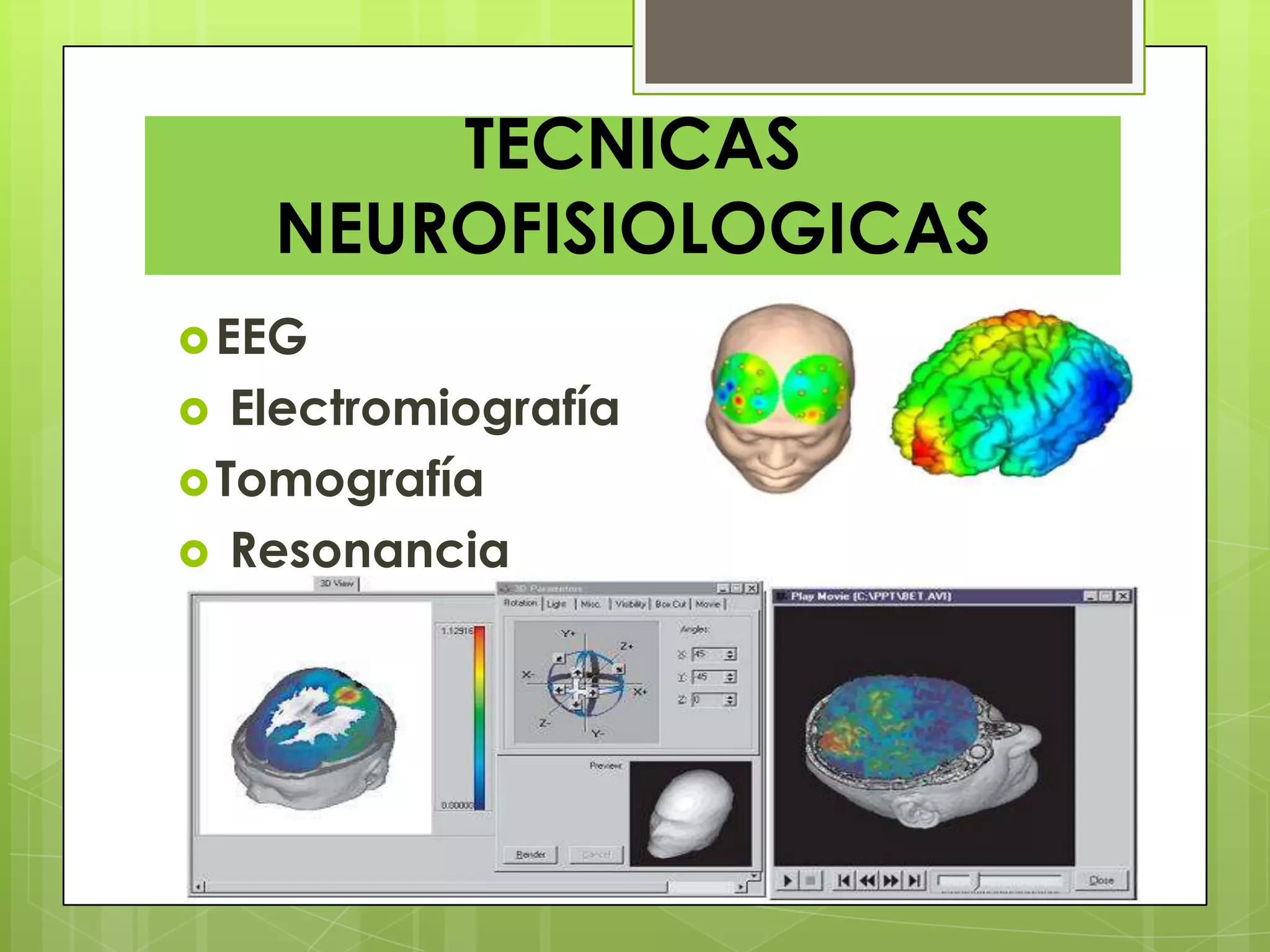 TECNICAS
NEUROFISIOLOGICAS
EEG
 Electromiografía
Tomografía
 Resonancia
 