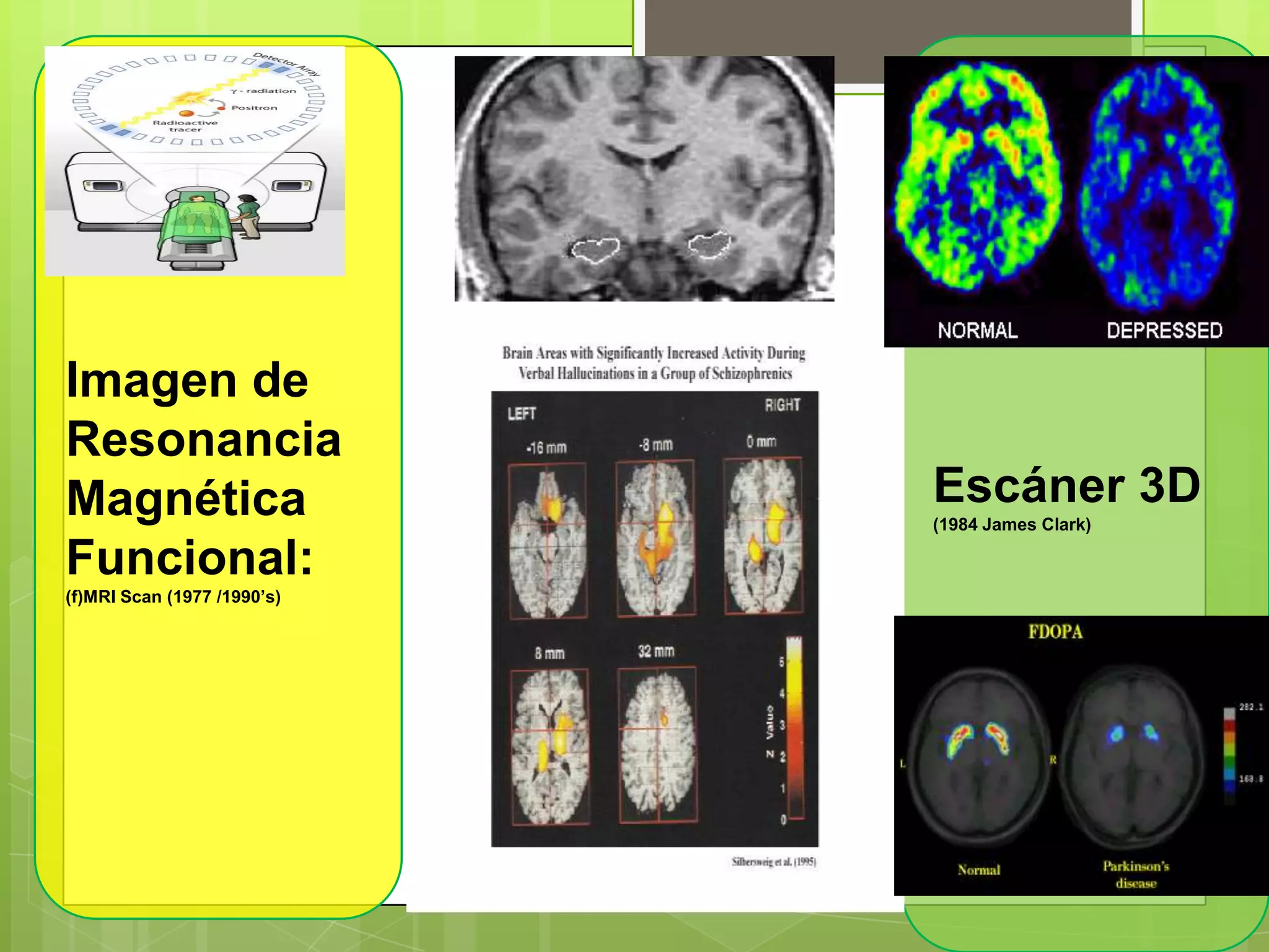 Imagen de
Resonancia
Magnética
Funcional:
(f)MRI Scan (1977 /1990’s)
Escáner 3D
(1984 James Clark)
 