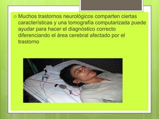  Muchos trastornos neurológicos comparten ciertas
características y una tomografía computarizada puede
ayudar para hacer el diagnóstico correcto
diferenciando el área cerebral afectado por el
trastorno
 