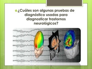 ¿Cuáles son algunas pruebas de
diagnóstico usadas para
diagnosticar trastornos
neurológicos?
 