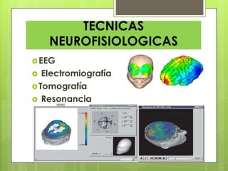 TECNICAS
NEUROFISIOLOGICAS
EEG
 Electromiografía
Tomografía
 Resonancia
 