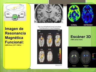 Imagen de
Resonancia
Magnética
Funcional:
(f)MRI Scan (1977 /1990’s)
Escáner 3D
(1984 James Clark)
 