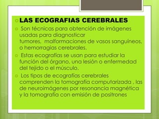 LAS ECOGRAFIAS CEREBRALES
 Son técnicas para obtención de imágenes
usadas para diagnosticar
tumores, malformaciones de vasos sanguíneos,
o hemorragias cerebrales.
 Estas ecografías se usan para estudiar la
función del órgano, una lesión o enfermedad
del tejido o el músculo.
 Los tipos de ecografías cerebrales
comprenden la tomografía computarizada , las
de neuroimágenes por resonancia magnética
y la tomografía con emisión de positrones
 
