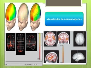 Visualizador de neuroimagenes
 