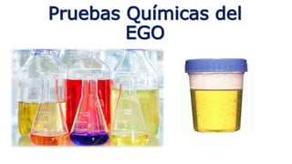 Pruebas Químicas del
EGO
 