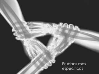 Pruebas mas
especificas

 