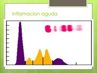 Inflamacion aguda

 