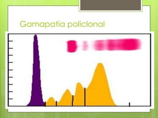 Gamapatia policlonal

 