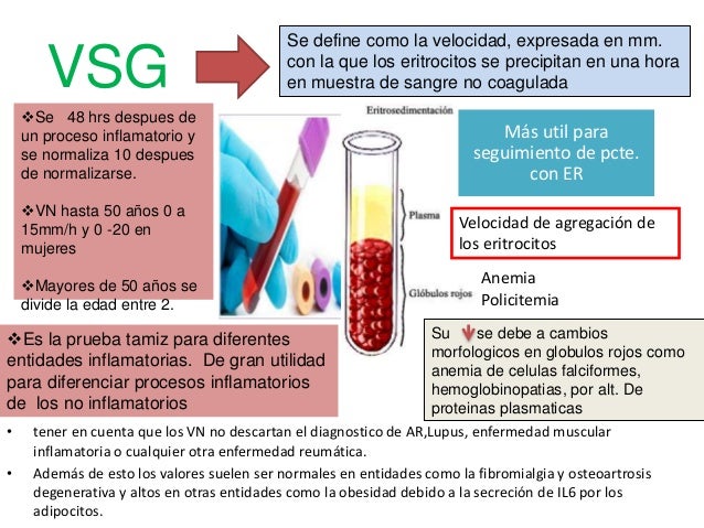 Pruebas reumatologicas Es muy buena. Gonzalo Cepeda. RIII medicina in…