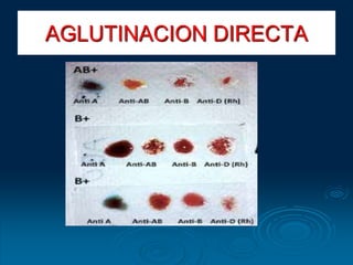 AGLUTINACION DIRECTA
 