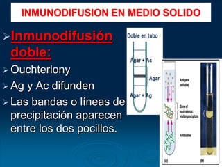 Inmunodifusión
doble:
Ouchterlony
Ag y Ac difunden
Las bandas o líneas de
precipitación aparecen
entre los dos pocillos.
INMUNODIFUSION EN MEDIO SOLIDO
 