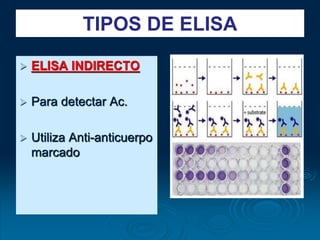 TIPOS DE ELISA
 ELISA INDIRECTO
 Para detectar Ac.
 Utiliza Anti-anticuerpo
marcado
 