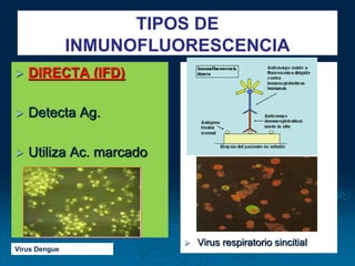 TIPOS DE
INMUNOFLUORESCENCIA
 DIRECTA (IFD)
 Detecta Ag.
 Utiliza Ac. marcado
 Virus respiratorio sincitial
Virus Dengue
 