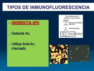  INDIRECTA (IFI)
 Detecta Ac.
 Utiliza Anti-Ac.
marcado
TIPOS DE INMUNOFLUORESCENCIA
 