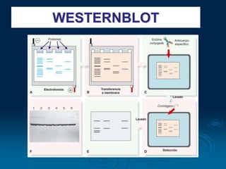 WESTERNBLOT
 