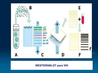 WESTERNBLOT para VIH
 