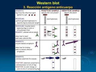 Western blot
3. Reacción antígeno:anticuerpo
 
