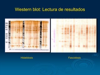Western blot: Lectura de resultados
Hidatidosis Fasciolosis
 