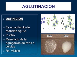  DEFINICION
 Es un acúmulo de
reacción Ag-Ac
 In vitro
 Resultado de la
agregación de m’os o
células
 Rx. Visible
AGLUTINACION
 