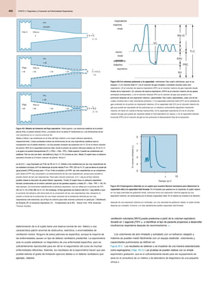 PARTE 2 • Diagnóstico y Evaluación de Enfermedades Respiratorias
PARTE 2 • Diagnóstico y Evaluación de Enfermedades Respiratorias
PARTE 2 • Diagnóstico y Evaluación de Enfermedades Respiratorias
408
ventilación voluntaria [ MVV] puede predecirse a partir de la volumen espiratorio
ventilación voluntaria [ MVV] puede predecirse a partir de la volumen espiratorio
ventilación voluntaria [ MVV] puede predecirse a partir de la volumen espiratorio
forzado en 1 segundo [ FEV 1]) 4 e identificar el tipo de paciente propensos a desarrollar
forzado en 1 segundo [ FEV 1]) 4 e identificar el tipo de paciente propensos a desarrollar
forzado en 1 segundo [ FEV 1]) 4 e identificar el tipo de paciente propensos a desarrollar
forzado en 1 segundo [ FEV 1]) 4 e identificar el tipo de paciente propensos a desarrollar
forzado en 1 segundo [ FEV 1]) 4 e identificar el tipo de paciente propensos a desarrollar
insuficiencia respiratoria después de neumonectomía. 5,6
insuficiencia respiratoria después de neumonectomía. 5,6
Los volúmenes de aire inhalado y exhalado con un esfuerzo relajado y
máxima se pueden medir fácilmente con un equipo estándar. volúmenes y
capacidades pulmonares se definen en
Figura 25-2 . Los resultados se obtienen y se muestran de una manera estandarizada
Figura 25-2 . Los resultados se obtienen y se muestran de una manera estandarizada
como espirograma ( Higo. 25-3 ). Las pruebas se pueden realizar con un simple
como espirograma ( Higo. 25-3 ). Las pruebas se pueden realizar con un simple
como espirograma ( Higo. 25-3 ). Las pruebas se pueden realizar con un simple
espirómetro grabación, que es lo suficientemente barato para ser equipamiento de
serie en el consultorio de un médico o de laboratorio de diagnóstico de una pequeña
clínica o
determinación de si el sujeto tiene una reserva normal de ven- tilatory o una
característica patrón anormal de obstructiva, restrictiva, o anormalidades de
ventilación mixtos. Ninguno de estos patrones es específica, aunque la mayoría de
las enfermedades causan un tipo de defecto ventilatorio predecible. La espirometría
sola no puede establecer un diagnóstico de una enfermedad específica, pero es
suficientemente reproducible para ser útil en el seguimiento del curso de muchas
enfermedades diferentes. Además, los resultados de la espirometría hacen que sea
posible estimar el grado de limitación ejercicio debido a un defecto ventilatorio (por
ejemplo, máximo
ejemplo, máximo
Figura 25-1 Modelo de limitación del flujo espiratorio. Parte superior, Las relaciones estáticas de la presión
Figura 25-1 Modelo de limitación del flujo espiratorio. Parte superior, Las relaciones estáticas de la presión
Figura 25-1 Modelo de limitación del flujo espiratorio. Parte superior, Las relaciones estáticas de la presión
Figura 25-1 Modelo de limitación del flujo espiratorio. Parte superior, Las relaciones estáticas de la presión
pleural (Ppl), la presión alveolar (Palv), y la presión de la vía aérea (P intraluminal AW), y las dimensiones de las
pleural (Ppl), la presión alveolar (Palv), y la presión de la vía aérea (P intraluminal AW), y las dimensiones de las
pleural (Ppl), la presión alveolar (Palv), y la presión de la vía aérea (P intraluminal AW), y las dimensiones de las
vías respiratorias en un volumen pulmonar fijo.
Media e inferior, Las condiciones en el inicio del flujo máximo y con mayor esfuerzo espiratorio,
Media e inferior, Las condiciones en el inicio del flujo máximo y con mayor esfuerzo espiratorio,
respectivamente. Líneas punteadas mostrar las dimensiones de las vías respiratorias estáticas para la
respectivamente. Líneas punteadas mostrar las dimensiones de las vías respiratorias estáticas para la
respectivamente. Líneas punteadas mostrar las dimensiones de las vías respiratorias estáticas para la
comparación con el estado dinámico. Los tres paneles muestran las presiones (cm H2 O) en el mismo volumen
comparación con el estado dinámico. Los tres paneles muestran las presiones (cm H2 O) en el mismo volumen
comparación con el estado dinámico. Los tres paneles muestran las presiones (cm H2 O) en el mismo volumen
de pulmón: 60% de la capacidad pulmonar total, donde la presión de pulmón retroceso elástico es 16 cm H2 O
de pulmón: 60% de la capacidad pulmonar total, donde la presión de pulmón retroceso elástico es 16 cm H2 O
de pulmón: 60% de la capacidad pulmonar total, donde la presión de pulmón retroceso elástico es 16 cm H2 O
y es igual a la presión transpulmonar (P L) ( PAG L = Palv - PPL). Parte superior, Cuando las condiciones son
y es igual a la presión transpulmonar (P L) ( PAG L = Palv - PPL). Parte superior, Cuando las condiciones son
y es igual a la presión transpulmonar (P L) ( PAG L = Palv - PPL). Parte superior, Cuando las condiciones son
y es igual a la presión transpulmonar (P L) ( PAG L = Palv - PPL). Parte superior, Cuando las condiciones son
y es igual a la presión transpulmonar (P L) ( PAG L = Palv - PPL). Parte superior, Cuando las condiciones son
y es igual a la presión transpulmonar (P L) ( PAG L = Palv - PPL). Parte superior, Cuando las condiciones son
y es igual a la presión transpulmonar (P L) ( PAG L = Palv - PPL). Parte superior, Cuando las condiciones son
y es igual a la presión transpulmonar (P L) ( PAG L = Palv - PPL). Parte superior, Cuando las condiciones son
y es igual a la presión transpulmonar (P L) ( PAG L = Palv - PPL). Parte superior, Cuando las condiciones son
estáticas, Palv es cero (es decir, atmosférico) y flujo ( V ) En la boca es cero. Medio, El sujeto hace un esfuerzo
estáticas, Palv es cero (es decir, atmosférico) y flujo ( V ) En la boca es cero. Medio, El sujeto hace un esfuerzo
estáticas, Palv es cero (es decir, atmosférico) y flujo ( V ) En la boca es cero. Medio, El sujeto hace un esfuerzo
estáticas, Palv es cero (es decir, atmosférico) y flujo ( V ) En la boca es cero. Medio, El sujeto hace un esfuerzo
estáticas, Palv es cero (es decir, atmosférico) y flujo ( V ) En la boca es cero. Medio, El sujeto hace un esfuerzo
espiratorio forzado en el mismo volumen de pulmón. Ahora V
espiratorio forzado en el mismo volumen de pulmón. Ahora V
es de 6,5 L / seg impulsado por Palv de 36 cm H2 O. Debido a las resistencias por las vías respiratorias de
es de 6,5 L / seg impulsado por Palv de 36 cm H2 O. Debido a las resistencias por las vías respiratorias de
es de 6,5 L / seg impulsado por Palv de 36 cm H2 O. Debido a las resistencias por las vías respiratorias de
los alvéolos a la boca, el P AW disminuye al punto donde P AW = PPL (20 cm H2 O, que se llama el punto de
los alvéolos a la boca, el P AW disminuye al punto donde P AW = PPL (20 cm H2 O, que se llama el punto de
los alvéolos a la boca, el P AW disminuye al punto donde P AW = PPL (20 cm H2 O, que se llama el punto de
los alvéolos a la boca, el P AW disminuye al punto donde P AW = PPL (20 cm H2 O, que se llama el punto de
los alvéolos a la boca, el P AW disminuye al punto donde P AW = PPL (20 cm H2 O, que se llama el punto de
los alvéolos a la boca, el P AW disminuye al punto donde P AW = PPL (20 cm H2 O, que se llama el punto de
los alvéolos a la boca, el P AW disminuye al punto donde P AW = PPL (20 cm H2 O, que se llama el punto de
los alvéolos a la boca, el P AW disminuye al punto donde P AW = PPL (20 cm H2 O, que se llama el punto de
igual presión [ PPE] porque pers = P AW). Entre el alvéolo y el PPE, las vías respiratorias no se comprimen,
igual presión [ PPE] porque pers = P AW). Entre el alvéolo y el PPE, las vías respiratorias no se comprimen,
igual presión [ PPE] porque pers = P AW). Entre el alvéolo y el PPE, las vías respiratorias no se comprimen,
igual presión [ PPE] porque pers = P AW). Entre el alvéolo y el PPE, las vías respiratorias no se comprimen,
pero distal al EPP hay compresión y el estrechamiento de las vías respiratorias, porque pers excede la
presión dentro de las vías respiratorias. Para este volumen pulmonar, 6,5 l / seg es el flujo máximo
posible (véase la discusión de panel inferior, siguiente). Fondo, El sujeto hace un esfuerzo espiratorio
posible (véase la discusión de panel inferior, siguiente). Fondo, El sujeto hace un esfuerzo espiratorio
posible (véase la discusión de panel inferior, siguiente). Fondo, El sujeto hace un esfuerzo espiratorio
posible (véase la discusión de panel inferior, siguiente). Fondo, El sujeto hace un esfuerzo espiratorio
posible (véase la discusión de panel inferior, siguiente). Fondo, El sujeto hace un esfuerzo espiratorio
forzado comenzando en el mismo volumen que en los paneles superior y medio (P L = Palv - PPL = 16). En
forzado comenzando en el mismo volumen que en los paneles superior y medio (P L = Palv - PPL = 16). En
forzado comenzando en el mismo volumen que en los paneles superior y medio (P L = Palv - PPL = 16). En
forzado comenzando en el mismo volumen que en los paneles superior y medio (P L = Palv - PPL = 16). En
forzado comenzando en el mismo volumen que en los paneles superior y medio (P L = Palv - PPL = 16). En
este ejemplo, se incrementa notablemente el esfuerzo espiratorio, que se refleja por el aumento de PPL
(50 cm H2 O) y Palv (66 cm H2 O). Sin embargo, el flujo generado es todavía sólo 6,5 l / seg debido a que
(50 cm H2 O) y Palv (66 cm H2 O). Sin embargo, el flujo generado es todavía sólo 6,5 l / seg debido a que
(50 cm H2 O) y Palv (66 cm H2 O). Sin embargo, el flujo generado es todavía sólo 6,5 l / seg debido a que
(50 cm H2 O) y Palv (66 cm H2 O). Sin embargo, el flujo generado es todavía sólo 6,5 l / seg debido a que
(50 cm H2 O) y Palv (66 cm H2 O). Sin embargo, el flujo generado es todavía sólo 6,5 l / seg debido a que
el aumento del esfuerzo sólo tiene éxito en la compresión de las vías respiratorias más, disipando la
presión a través de la conducción de una mayor aumento de la resistencia ofrecida por las vías
respiratorias más estrechas; así el flujo es máximo para este volumen pulmonar en particular. ( Modificado
respiratorias más estrechas; así el flujo es máximo para este volumen pulmonar en particular. ( Modificado
de Rodarte JR: la mecánica respiratoria. En Fundamentos de la RD, Nueva York, 1976, American
de Rodarte JR: la mecánica respiratoria. En Fundamentos de la RD, Nueva York, 1976, American
de Rodarte JR: la mecánica respiratoria. En Fundamentos de la RD, Nueva York, 1976, American
Thoracic Society).
Palv 0
0 0 V = 0
PAG AW
PAG AW
PPL
-dieciséis
PPL
+ 20
(L / s)
Palv
+ 36 + 36 + 30 + 20 0
PAG AW
PAG AW
PPL
+ 50
Palv
+ 66 + 66 + 60 + 50 0 V = 6,5
PAG AW
PAG AW
(L / s)
•
V = 6,5 (L
/ s)
•
•
Figura 25-2 el volumen pulmonar y la capacidad. volúmenes: Hay cuatro volúmenes, que no se
Figura 25-2 el volumen pulmonar y la capacidad. volúmenes: Hay cuatro volúmenes, que no se
Figura 25-2 el volumen pulmonar y la capacidad. volúmenes: Hay cuatro volúmenes, que no se
Figura 25-2 el volumen pulmonar y la capacidad. volúmenes: Hay cuatro volúmenes, que no se
solapan: (1) el volumen tidal (V T) es el volumen de gas inhalado o exhalado durante cada ciclo
solapan: (1) el volumen tidal (V T) es el volumen de gas inhalado o exhalado durante cada ciclo
solapan: (1) el volumen tidal (V T) es el volumen de gas inhalado o exhalado durante cada ciclo
respiratorio; (2) el volumen de reserva inspiratorio (IRV) es el volumen máximo de gas inspirado desde
finales de la inspiración; (3) volumen de reserva espiratorio ( ERV) es el volumen máximo de los gases
finales de la inspiración; (3) volumen de reserva espiratorio ( ERV) es el volumen máximo de los gases
finales de la inspiración; (3) volumen de reserva espiratorio ( ERV) es el volumen máximo de los gases
exhalados endexpiration; y (4) el volumen residual (RV) es el volumen de gas que queda en los
pulmones después de una espiración máxima. capacidades: Hay cuatro capacidades, cada una de las
pulmones después de una espiración máxima. capacidades: Hay cuatro capacidades, cada una de las
pulmones después de una espiración máxima. capacidades: Hay cuatro capacidades, cada una de las
cuales contiene dos o más volúmenes primarios: (1) la capacidad pulmonar total (CPT) es la cantidad de
gas contenido en el pulmón en inspiración máxima; (2) la capacidad vital (CV) es el volumen máximo de
gas que puede ser expulsado de los pulmones por un esfuerzo contundente siguientes inspiración
máxima, sin tener en cuenta el tiempo transcurrido; (3) la capacidad inspiratoria (CI) es el volumen
máximo de gas que puede ser inspirado desde el nivel espiratorio en reposo; y (4) la capacidad residual
funcional (FRC) es el volumen de gas en los pulmones al descansando final de la espiración.
VC
IRV IC
TLC
ERV
FRC
RV
V T
V T
inspiratoria
máxima
nivel
espiratorio
máximo
espiratorio
nivel de
reposo
nivel
Figura 25-3 Espirograma obtenido en un sujeto que muestra Normal maniobras para determinar la
Figura 25-3 Espirograma obtenido en un sujeto que muestra Normal maniobras para determinar la
capacidad vital y la capacidad vital forzada. En el trazado que aparece en la izquierda, el sujeto respira
capacidad vital y la capacidad vital forzada. En el trazado que aparece en la izquierda, el sujeto respira
capacidad vital y la capacidad vital forzada. En el trazado que aparece en la izquierda, el sujeto respira
capacidad vital y la capacidad vital forzada. En el trazado que aparece en la izquierda, el sujeto respira
en voz baja (velocidad de grabación lenta), entonces toma una inspiración máxima seguida de una
espiración máxima, sin preocuparse por el tiempo (capacidad vital). En el rastreo se muestra a la derecho,
espiración máxima, sin preocuparse por el tiempo (capacidad vital). En el rastreo se muestra a la derecho,
después de una inspiración máxima (no mostrada), con una velocidad de grabación rápida, el sujeto exhala
después por completo, la fuerza, y lo más rápidamente posible (capacidad vital forzada).
Tiempo (s) 0
5 10
0
1
2
3
4
5
El
volumen
exhalado
(L)
 
