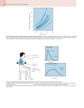 PARTE 2 • Diagnóstico y Evaluación de Enfermedades Respiratorias
PARTE 2 • Diagnóstico y Evaluación de Enfermedades Respiratorias
PARTE 2 • Diagnóstico y Evaluación de Enfermedades Respiratorias
435.e8
eFigure 25-15 presión de oclusión inspiratoria a 100 mseg (0,1 segundos) en respuesta a la hipercapnia. Cada curva es la regresión media de presión en la boca en 0,1 segundos frente a P. CO 2 para un sujeto.
eFigure 25-15 presión de oclusión inspiratoria a 100 mseg (0,1 segundos) en respuesta a la hipercapnia. Cada curva es la regresión media de presión en la boca en 0,1 segundos frente a P. CO 2 para un sujeto.
eFigure 25-15 presión de oclusión inspiratoria a 100 mseg (0,1 segundos) en respuesta a la hipercapnia. Cada curva es la regresión media de presión en la boca en 0,1 segundos frente a P. CO 2 para un sujeto.
eFigure 25-15 presión de oclusión inspiratoria a 100 mseg (0,1 segundos) en respuesta a la hipercapnia. Cada curva es la regresión media de presión en la boca en 0,1 segundos frente a P. CO 2 para un sujeto.
eFigure 25-15 presión de oclusión inspiratoria a 100 mseg (0,1 segundos) en respuesta a la hipercapnia. Cada curva es la regresión media de presión en la boca en 0,1 segundos frente a P. CO 2 para un sujeto.
eFigure 25-15 presión de oclusión inspiratoria a 100 mseg (0,1 segundos) en respuesta a la hipercapnia. Cada curva es la regresión media de presión en la boca en 0,1 segundos frente a P. CO 2 para un sujeto.
presión de oclusión inspiratoria puede ser utilizado para medir la salida del centro respiratorio en respuesta no sólo a la hipercapnia, sino también a la hipoxia, el ejercicio y otros factores. ( Modificado de Whitelaw
presión de oclusión inspiratoria puede ser utilizado para medir la salida del centro respiratorio en respuesta no sólo a la hipercapnia, sino también a la hipoxia, el ejercicio y otros factores. ( Modificado de Whitelaw
WA, Dernne J, Milic-Emili J: Presión de oclusión como una medida de la producción del centro respiratorio en el hombre consciente. Respir Physiol 23: 181-199, 1975.)
WA, Dernne J, Milic-Emili J: Presión de oclusión como una medida de la producción del centro respiratorio en el hombre consciente. Respir Physiol 23: 181-199, 1975.)
WA, Dernne J, Milic-Emili J: Presión de oclusión como una medida de la producción del centro respiratorio en el hombre consciente. Respir Physiol 23: 181-199, 1975.)
PAG CO 2 ( mm Hg)
PAG CO 2 ( mm Hg)
PAG CO 2 ( mm Hg)
PAG CO 2 ( mm Hg)
60 70 80
25
20
15
10
5
0
50
eFigure 25-16 La evaluación de la función pulmonar regional a partir de xenon-133 (133 Xe). Parte superior, Después de la inyección, el pico inicial refleja el flujo de sangre regional ( Q do
eFigure 25-16 La evaluación de la función pulmonar regional a partir de xenon-133 (133 Xe). Parte superior, Después de la inyección, el pico inicial refleja el flujo de sangre regional ( Q do
eFigure 25-16 La evaluación de la función pulmonar regional a partir de xenon-133 (133 Xe). Parte superior, Después de la inyección, el pico inicial refleja el flujo de sangre regional ( Q do
eFigure 25-16 La evaluación de la función pulmonar regional a partir de xenon-133 (133 Xe). Parte superior, Después de la inyección, el pico inicial refleja el flujo de sangre regional ( Q do
eFigure 25-16 La evaluación de la función pulmonar regional a partir de xenon-133 (133 Xe). Parte superior, Después de la inyección, el pico inicial refleja el flujo de sangre regional ( Q do
eFigure 25-16 La evaluación de la función pulmonar regional a partir de xenon-133 (133 Xe). Parte superior, Después de la inyección, el pico inicial refleja el flujo de sangre regional ( Q do
eFigure 25-16 La evaluación de la función pulmonar regional a partir de xenon-133 (133 Xe). Parte superior, Después de la inyección, el pico inicial refleja el flujo de sangre regional ( Q do
eFigure 25-16 La evaluación de la función pulmonar regional a partir de xenon-133 (133 Xe). Parte superior, Después de la inyección, el pico inicial refleja el flujo de sangre regional ( Q do
); el isótopo a continuación, pasa a la fase de gas, en la que la distancia durante la respiración normal refleja la ventilación del tejido pulmonar que se perfunde. Un lavado lento indica una baja relación
ventilación-perfusión ( V / Q
ventilación-perfusión ( V / Q C.A. ). Fondo, Durante la nueva respiración, la tasa de recuento meseta cuando la mezcla es completa refleja la
C.A. ). Fondo, Durante la nueva respiración, la tasa de recuento meseta cuando la mezcla es completa refleja la
C.A. ). Fondo, Durante la nueva respiración, la tasa de recuento meseta cuando la mezcla es completa refleja la
C.A. ). Fondo, Durante la nueva respiración, la tasa de recuento meseta cuando la mezcla es completa refleja la
volumen de gas de pulmón en el campo de recuento. Las pendientes de las curvas de lavado-en y de lavado indican la ventilación por unidad de volumen. ( Modificado de Costas JE: Función pulmonar, ed 4, Oxford, 1979,
volumen de gas de pulmón en el campo de recuento. Las pendientes de las curvas de lavado-en y de lavado indican la ventilación por unidad de volumen. ( Modificado de Costas JE: Función pulmonar, ed 4, Oxford, 1979,
volumen de gas de pulmón en el campo de recuento. Las pendientes de las curvas de lavado-en y de lavado indican la ventilación por unidad de volumen. ( Modificado de Costas JE: Función pulmonar, ed 4, Oxford, 1979,
volumen de gas de pulmón en el campo de recuento. Las pendientes de las curvas de lavado-en y de lavado indican la ventilación por unidad de volumen. ( Modificado de Costas JE: Función pulmonar, ed 4, Oxford, 1979,
Blackwell Scientific).
La inhalación de
nueva respiración de
gas
Inyección en
solución salina
Actividad (cps)
133 Xe inyecta
133 Xe inyecta
133 Xe volumen inhalado
133 Xe volumen inhalado
Qc
V UN/ Q do
V UN/ Q do
V UN/ Q do
V UN/ Q do
Ventilación /
volumen
Tiempo (min)
La inyección de
colorante y de muestreo
arterial
·
· ·
presión
en
la
boca
a
0,1
seg
(cm
H
2
O)
presión
en
la
boca
a
0,1
seg
(cm
H
2
O)
presión
en
la
boca
a
0,1
seg
(cm
H
2
O)
 
