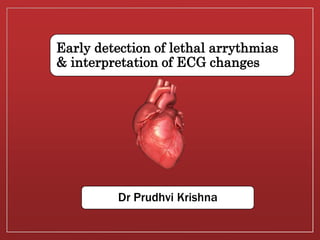 Early detection of lethal arrythmias
& interpretation of ECG changes
Dr Prudhvi Krishna
 