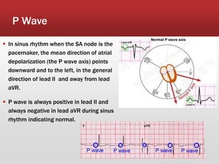 P Wave
 In sinus rhythm when the SA node is the
pacemaker, the mean direction of atrial
depolarization (the P wave axis) points
downward and to the left, in the general
direction of lead II and away from lead
aVR.
 P wave is always positive in lead II and
always negative in lead aVR during sinus
rhythm indicating normal.
 