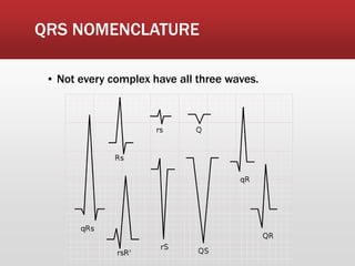 QRS NOMENCLATURE
▪ Not every complex have all three waves.
 