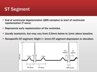 ST Segment
 End of ventricular depolarization (QRS complex) to start of ventricular
repolarization (T wave)
 Represents early repolarization of the ventricles.
 Usually isoelectric, but may vary from 0.5mm below to 1mm above baseline.
 Nonspecific ST segment: Slight (< 1mm) ST segment depression or elevation.
 