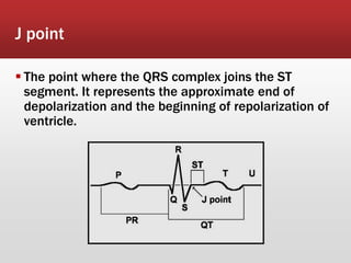 J point
 The point where the QRS complex joins the ST
segment. It represents the approximate end of
depolarization and the beginning of repolarization of
ventricle.
 