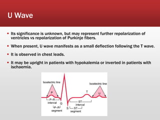 U Wave
 Its significance is unknown, but may represent further repolarization of
ventricles vs repolarization of Purkinje fibers.
 When present, U wave manifests as a small deflection following the T wave.
 It is observed in chest leads.
 It may be upright in patients with hypokalemia or inverted in patients with
ischaemia.
 