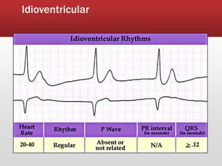 Idioventricular
 