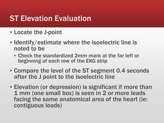 ST Elevation Evaluation
▪ Locate the J-point
▪ Identify/estimate where the isoelectric line is
noted to be
▪ Check the standardized 2mm mark at the far left or
beginning of each row of the EKG strip
▪ Compare the level of the ST segment 0.4 seconds
after the J point to the isoelectric line
▪ Elevation (or depression) is significant if more than
1 mm (one small box) is seen in 2 or more leads
facing the same anatomical area of the heart (ie:
contiguous leads)
 