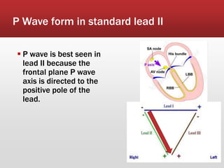 P Wave form in standard lead II
 P wave is best seen in
lead II because the
frontal plane P wave
axis is directed to the
positive pole of the
lead.
 