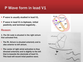 P Wave form in lead V1
 P wave is usually studied in lead V1.
 P wave in lead V1 is biphasic, initial
positivity and terminal negativity .
Reason:
1 .The SA node is situated in the right atrium
that activated first.
▪ The Rt. Atrium is situated anteriorly and is
also anterior to left atrium.
▪ The vector of right atrial activation is thus
directed anteriorly and is slightly to the left
that is towards the electrode of lead V1.
This lead will record intial positive wave.
 