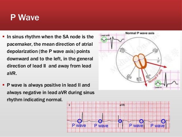 ecg basics and arrthymias p wave ecg