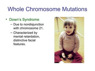 Whole Chromosome Mutations
• Down’s Syndrome
– Due to nondisjunction
with chromosome 21.
– Characterized by
mental retardation,
distinctive facial
features.
 